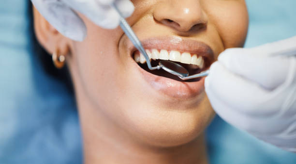 Best Urgent Care for Lost Fillings or Crowns in Bartonsville, MD