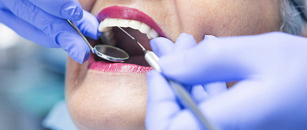Best Emergency Gum Treatment in Bartonsville, MD